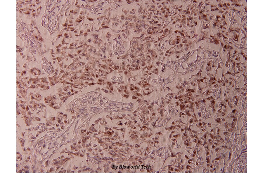 Anti-ATF2 (phospho-T73) Antibody from Bioworld Technology (BS4019) - Antibodies.com