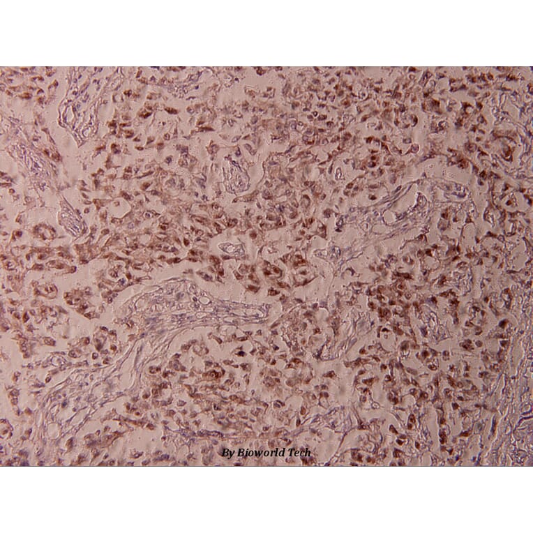 Anti-ATF2 (phospho-T73) Antibody from Bioworld Technology (BS4019) - Antibodies.com