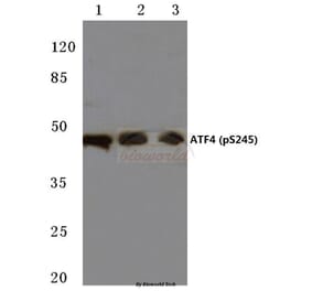 Anti-ATF4 (phospho-S245) Antibody from Bioworld Technology (BS4020) - Antibodies.com