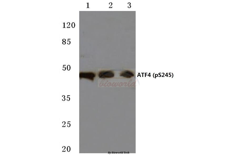 Anti-ATF4 (phospho-S245) Antibody from Bioworld Technology (BS4020) - Antibodies.com