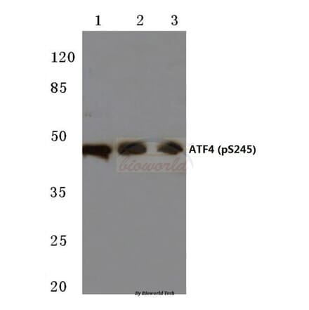 Anti-ATF4 (phospho-S245) Antibody from Bioworld Technology (BS4020) - Antibodies.com