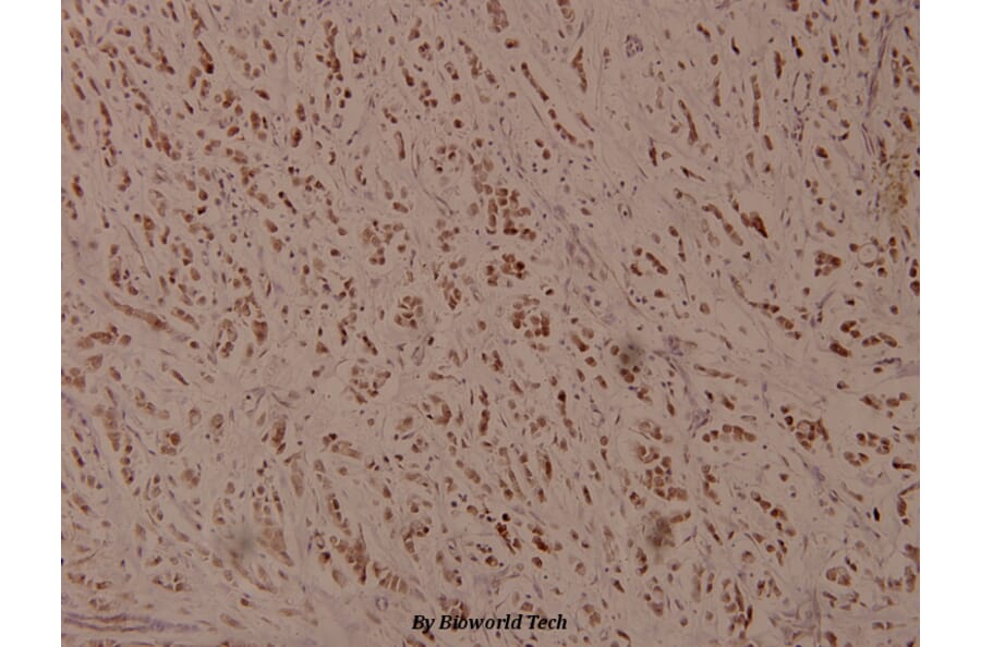 Anti-ATF4 (phospho-S245) Antibody from Bioworld Technology (BS4020) - Antibodies.com