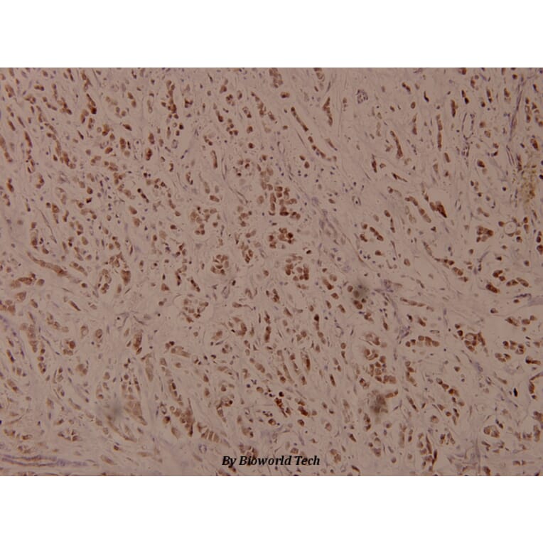 Anti-ATF4 (phospho-S245) Antibody from Bioworld Technology (BS4020) - Antibodies.com