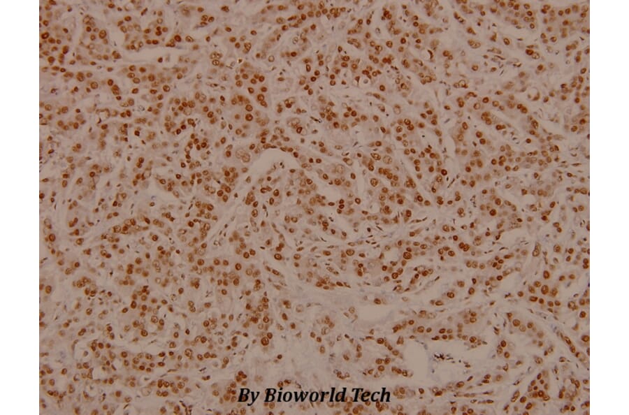 Anti-Bad (phospho-S136) Antibody from Bioworld Technology (BS4021) - Antibodies.com