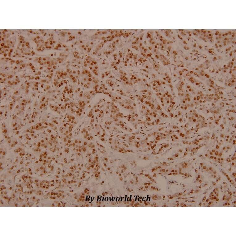 Anti-Bad (phospho-S136) Antibody from Bioworld Technology (BS4021) - Antibodies.com