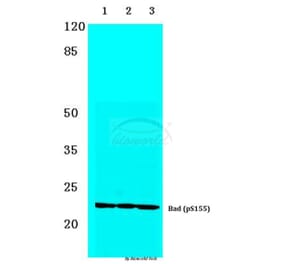 Anti-Bad (phospho-S155) Antibody from Bioworld Technology (BS4022) - Antibodies.com
