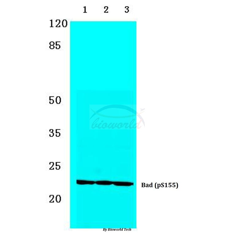 Anti-Bad (phospho-S155) Antibody from Bioworld Technology (BS4022) - Antibodies.com