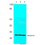 Anti-Bad (phospho-S155) Antibody from Bioworld Technology (BS4022) - Antibodies.com