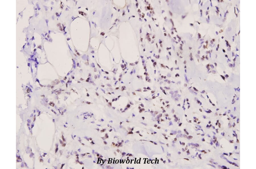 Anti-Bad (phospho-S155) Antibody from Bioworld Technology (BS4022) - Antibodies.com