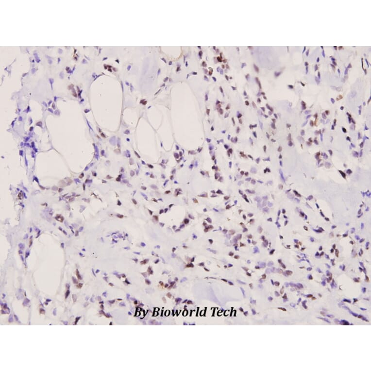 Anti-Bad (phospho-S155) Antibody from Bioworld Technology (BS4022) - Antibodies.com