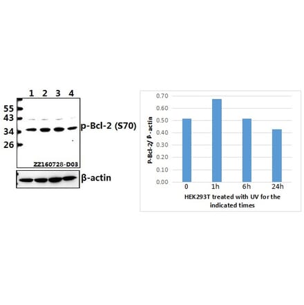 Anti-Bcl-2 (phospho-S70) Antibody from Bioworld Technology (BS4023) - Antibodies.com