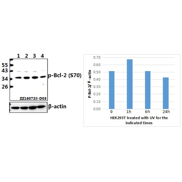 Anti-Bcl-2 (phospho-S70) Antibody from Bioworld Technology (BS4023) - Antibodies.com