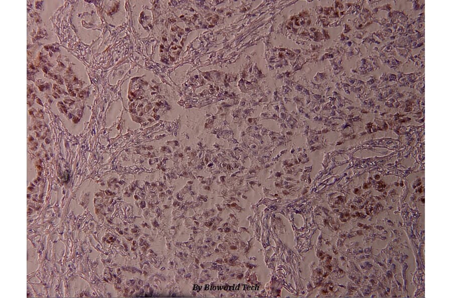 Anti-Bcl-2 (phospho-S70) Antibody from Bioworld Technology (BS4023) - Antibodies.com