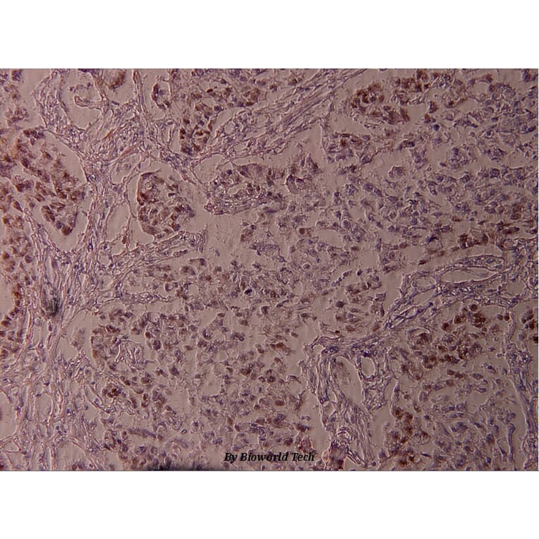 Anti-Bcl-2 (phospho-S70) Antibody from Bioworld Technology (BS4023) - Antibodies.com