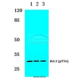Anti-Bcl-2 (phospho-T56) Antibody from Bioworld Technology (BS4024) - Antibodies.com