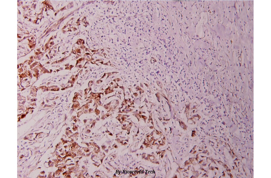 Anti-Bcl-2 (phospho-T56) Antibody from Bioworld Technology (BS4024) - Antibodies.com