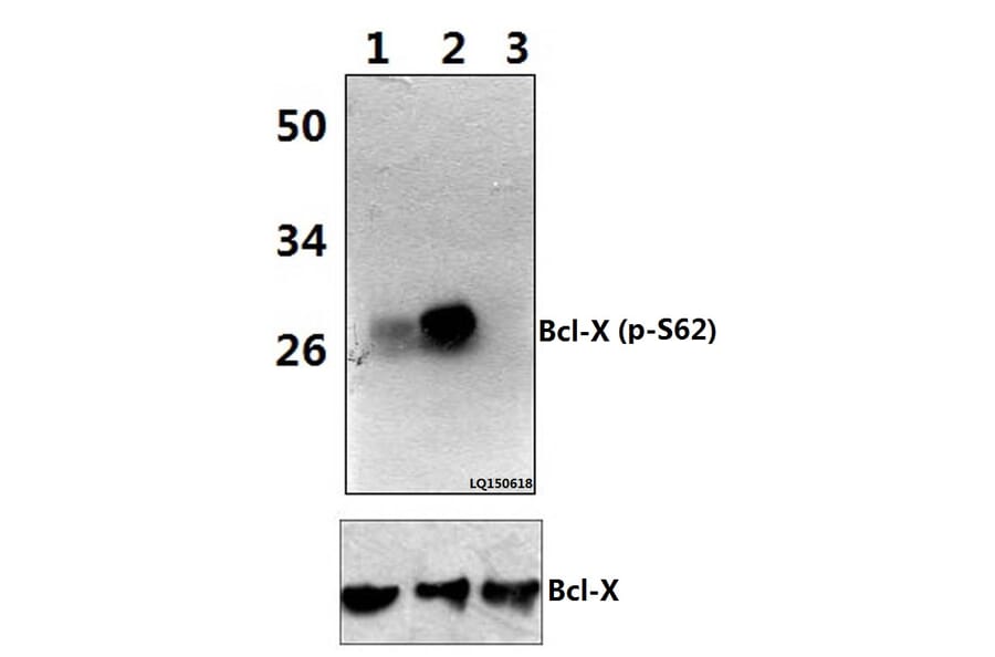 Anti-Bcl-X (phospho-S62) Antibody from Bioworld Technology (BS4025) - Antibodies.com