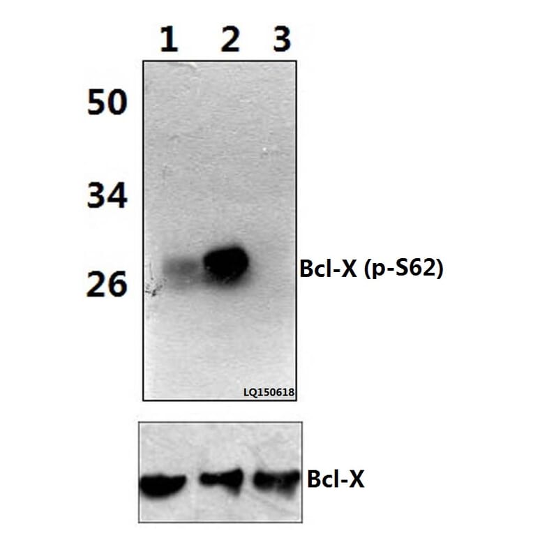 Anti-Bcl-X (phospho-S62) Antibody from Bioworld Technology (BS4025) - Antibodies.com