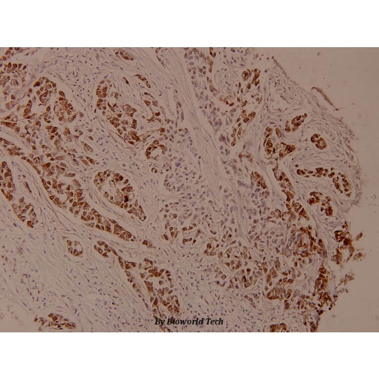 Anti-Bcl-X (phospho-S62) Antibody from Bioworld Technology (BS4025) - Antibodies.com