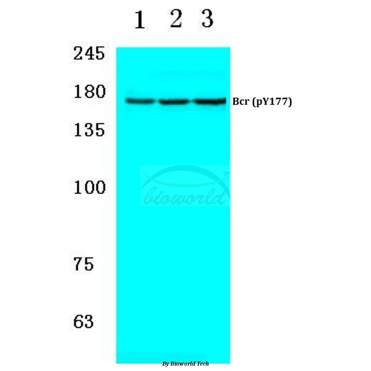 Anti-Bcr (phospho-Y177) Antibody from Bioworld Technology (BS4026) - Antibodies.com