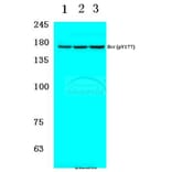 Anti-Bcr (phospho-Y177) Antibody from Bioworld Technology (BS4026) - Antibodies.com