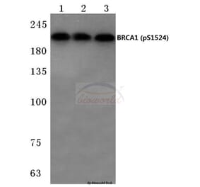 Anti-BRCA1 (phospho-S1524) Antibody from Bioworld Technology (BS4027) - Antibodies.com