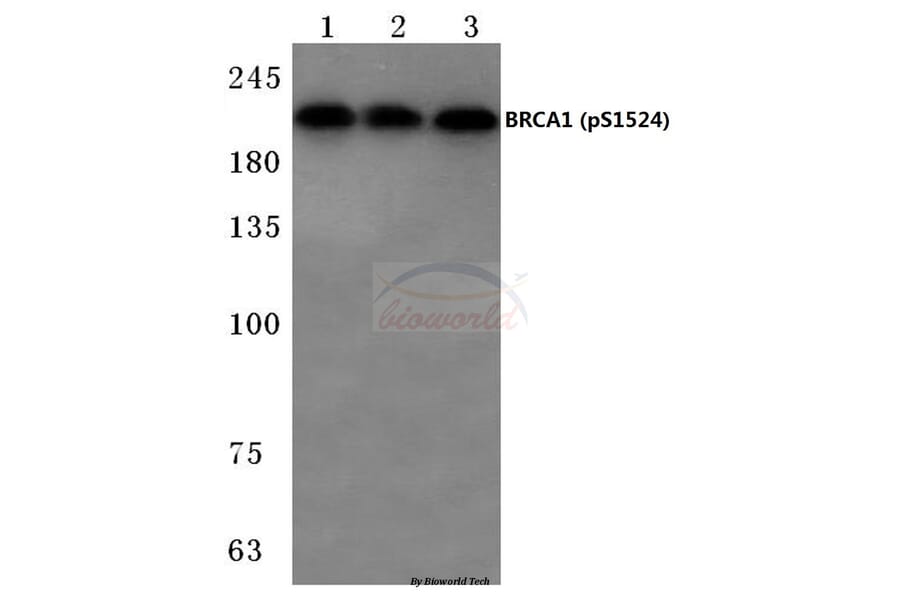 Anti-BRCA1 (phospho-S1524) Antibody from Bioworld Technology (BS4027) - Antibodies.com