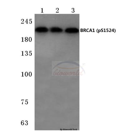 Anti-BRCA1 (phospho-S1524) Antibody from Bioworld Technology (BS4027) - Antibodies.com