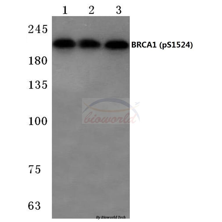 Anti-BRCA1 (phospho-S1524) Antibody from Bioworld Technology (BS4027) - Antibodies.com