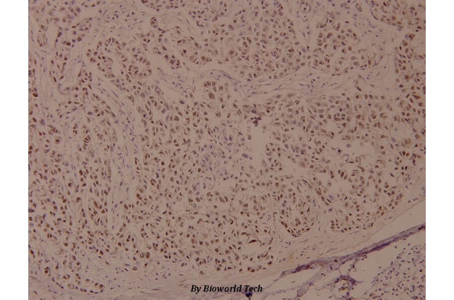 Anti-BRCA1 (phospho-S1524) Antibody from Bioworld Technology (BS4027) - Antibodies.com
