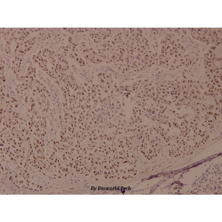 Anti-BRCA1 (phospho-S1524) Antibody from Bioworld Technology (BS4027) - Antibodies.com