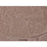 Anti-BRCA1 (phospho-S1524) Antibody from Bioworld Technology (BS4027) - Antibodies.com