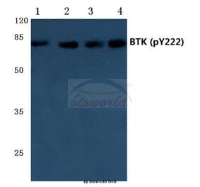 Anti-BTK (phospho-Y222) Antibody from Bioworld Technology (BS4028) - Antibodies.com