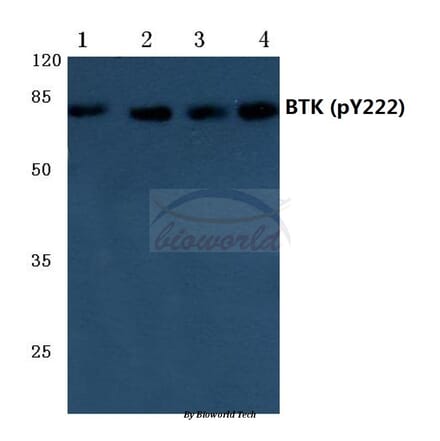 Anti-BTK (phospho-Y222) Antibody from Bioworld Technology (BS4028) - Antibodies.com