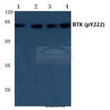 Anti-BTK (phospho-Y222) Antibody from Bioworld Technology (BS4028) - Antibodies.com
