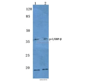 Anti-C/EBP-β (phospho-T235/188) Antibody from Bioworld Technology (BS4029) - Antibodies.com