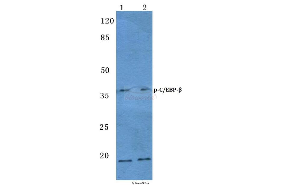 Anti-C/EBP-β (phospho-T235/188) Antibody from Bioworld Technology (BS4029) - Antibodies.com