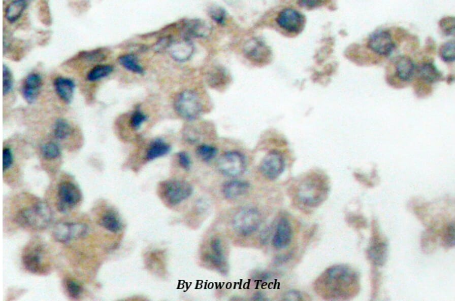 Anti-Catenin-β (phospho-T41/S45) Antibody from Bioworld Technology (BS4030) - Antibodies.com