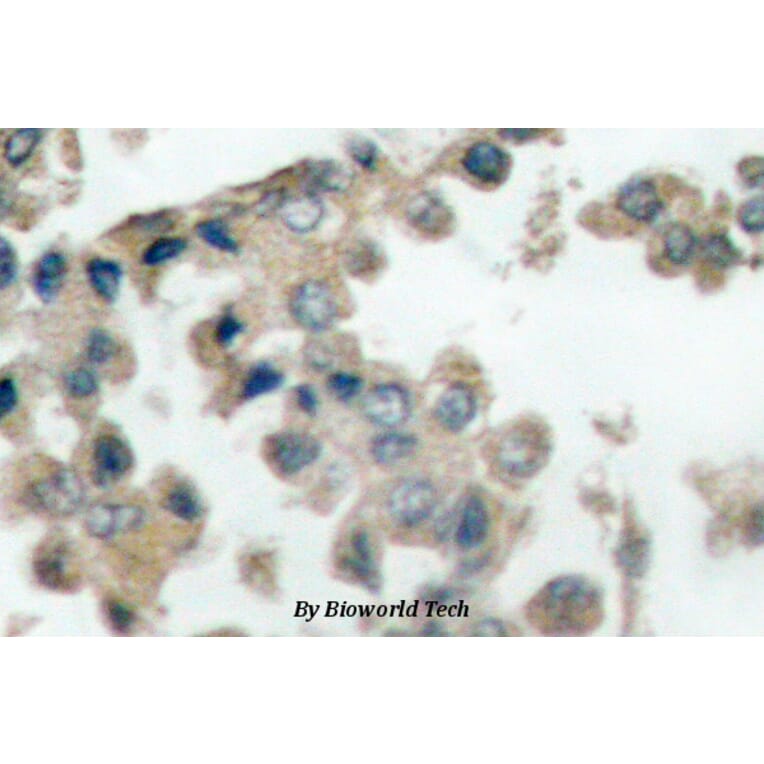 Anti-Catenin-β (phospho-T41/S45) Antibody from Bioworld Technology (BS4030) - Antibodies.com