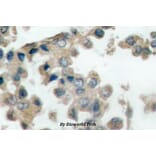 Anti-Catenin-β (phospho-T41/S45) Antibody from Bioworld Technology (BS4030) - Antibodies.com