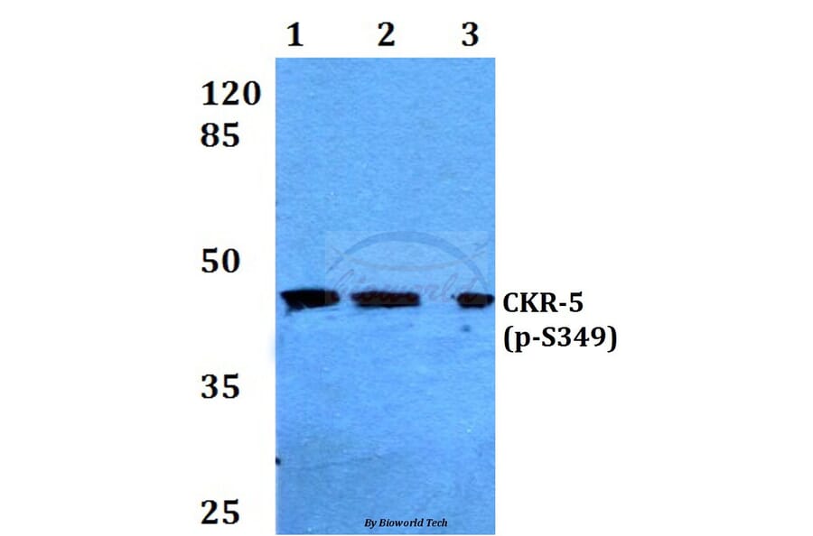 Anti-CKR-5 (phospho-S349) Antibody from Bioworld Technology (BS4032) - Antibodies.com