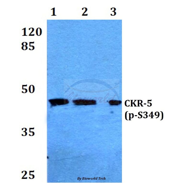 Anti-CKR-5 (phospho-S349) Antibody from Bioworld Technology (BS4032) - Antibodies.com