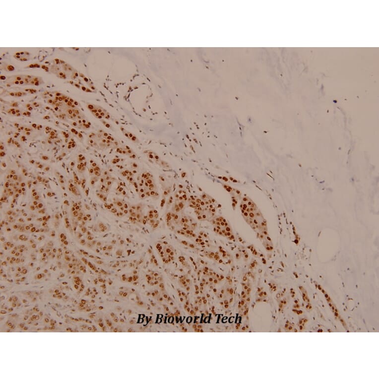 Anti-Cdk1/Cdc2 (phospho-T161) Antibody from Bioworld Technology (BS4033) - Antibodies.com