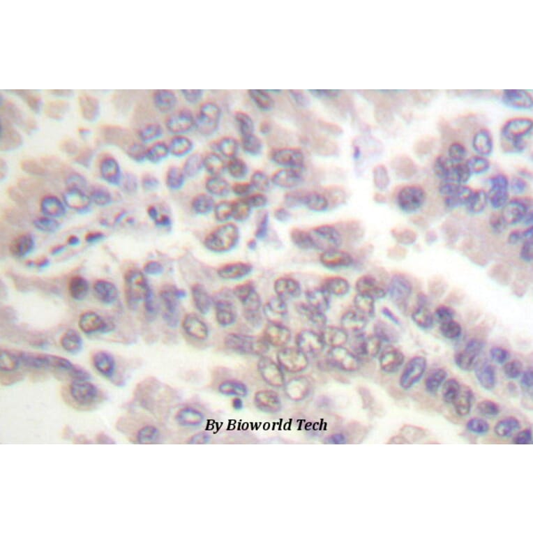 Anti-Cdc6 (phospho-S54) Antibody from Bioworld Technology (BS4036) - Antibodies.com