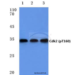 Anti-Cdk2 (phospho-T160) Antibody from Bioworld Technology (BS4038) - Antibodies.com
