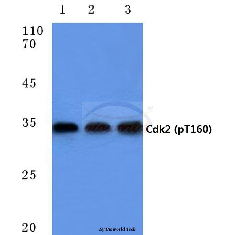 Anti-Cdk2 (phospho-T160) Antibody from Bioworld Technology (BS4038) - Antibodies.com