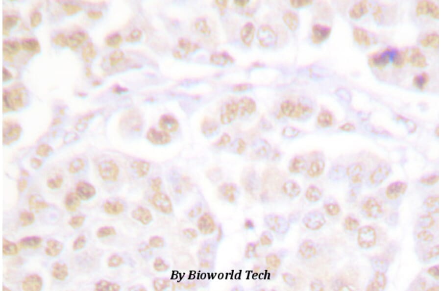 Anti-Cdk2 (phospho-T160) Antibody from Bioworld Technology (BS4038) - Antibodies.com