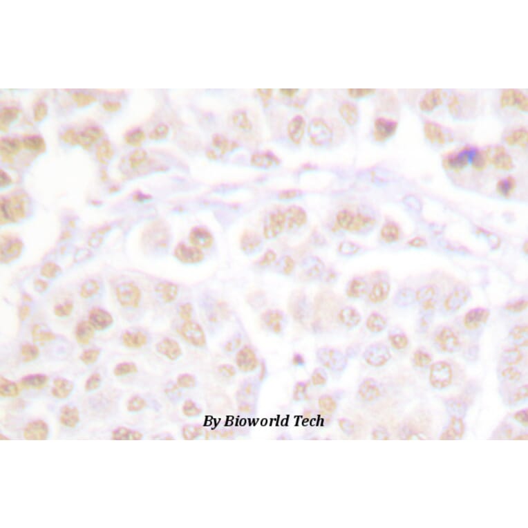 Anti-Cdk2 (phospho-T160) Antibody from Bioworld Technology (BS4038) - Antibodies.com