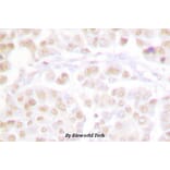 Anti-Cdk2 (phospho-T160) Antibody from Bioworld Technology (BS4038) - Antibodies.com