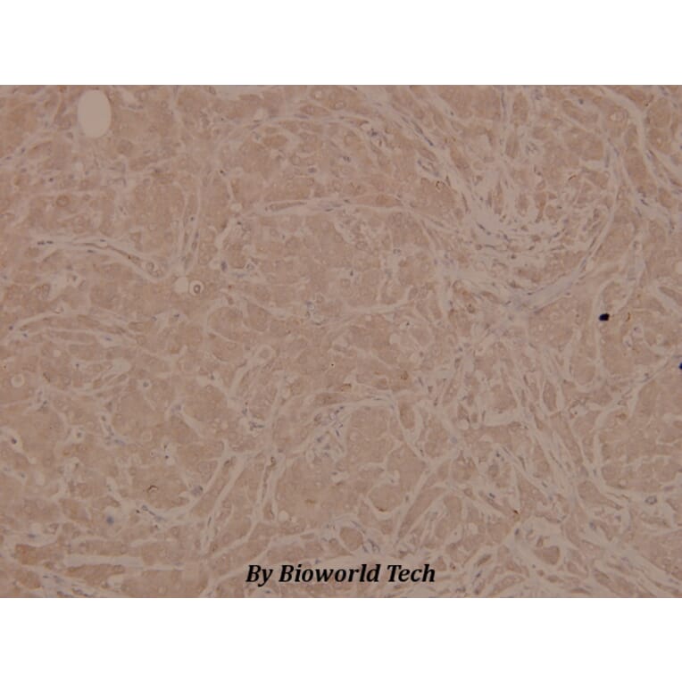 Anti-Chk1 (phospho-S345) Antibody from Bioworld Technology (BS4041) - Antibodies.com